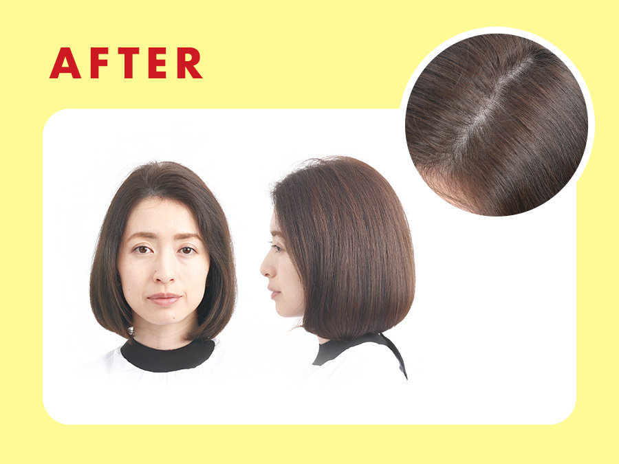 アフターイメージ